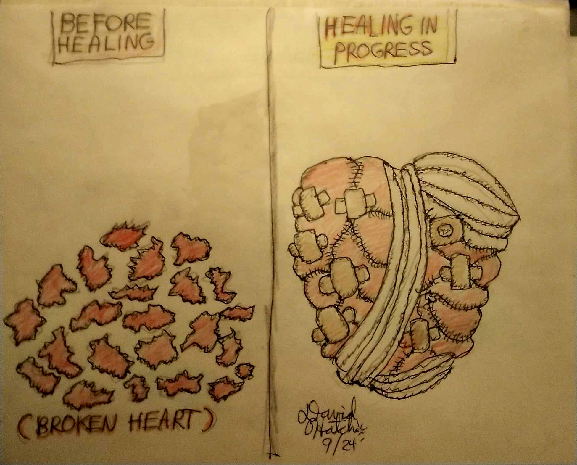 "Healing in Progress" by David Hatch